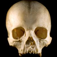 Human skull picture